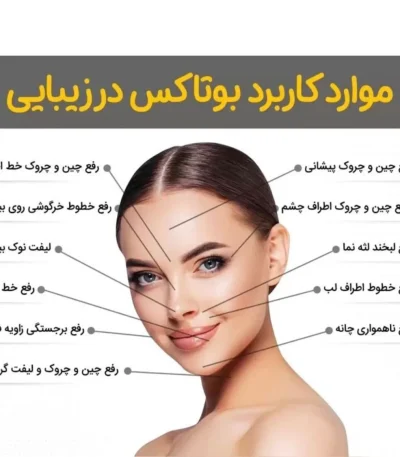 قیمت بوتاکس مصپورت اصل